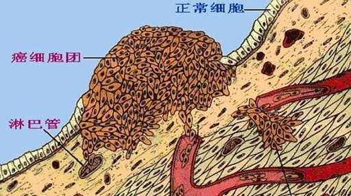 关于癌症的思考