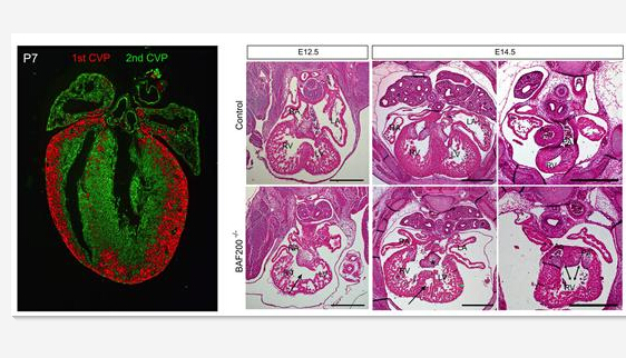 上海生科院：发现心脏及冠状动脉发育调控的新机制