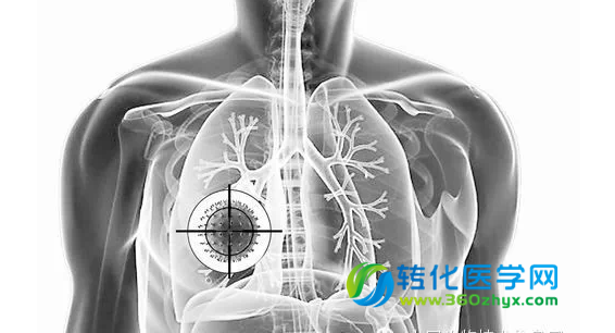 肺癌靶向药物“加速”走向临床