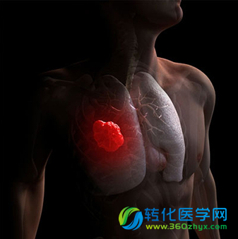 威斯达研究所与OncoCyte公司扩大肺癌检测技术协议