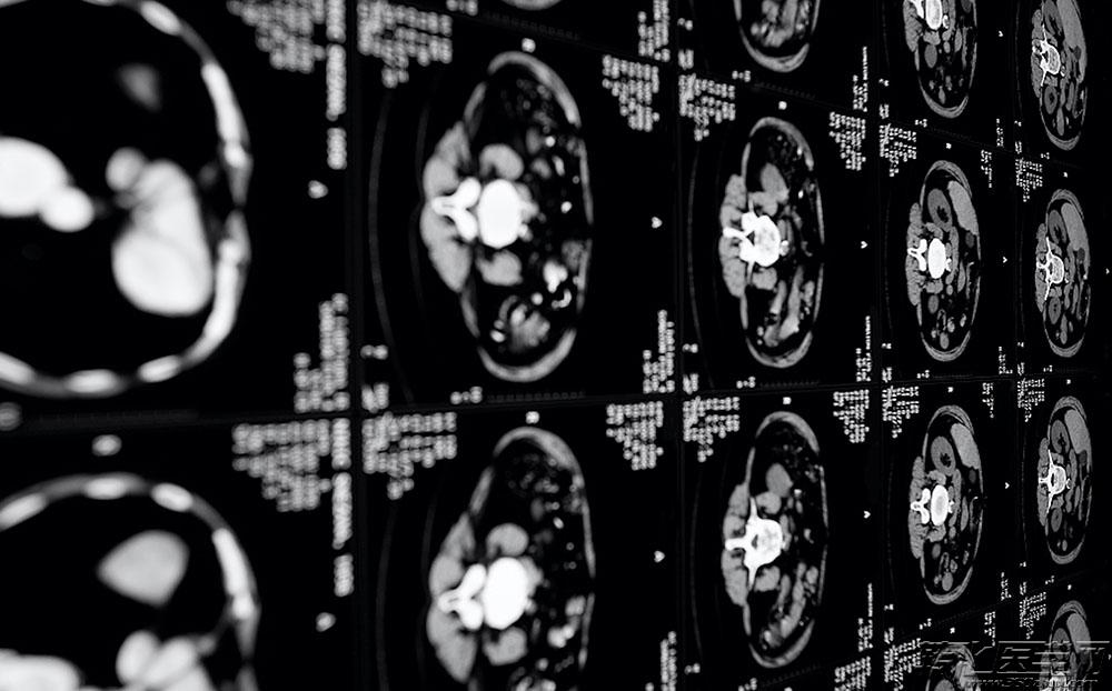 云计算+影像医生=超级医生，一场技术与医疗革命性融合的论坛重磅来袭！