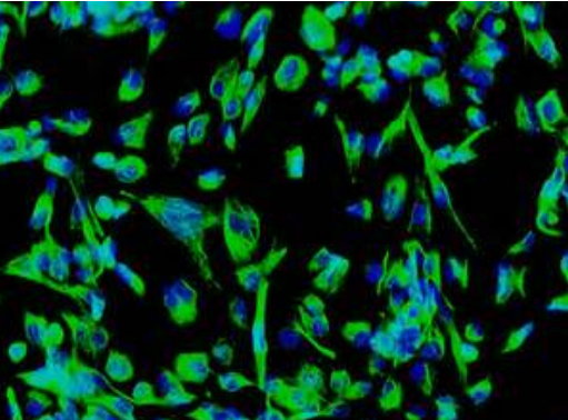 StemCellRep：干细胞疗法或可靶向治疗骨关节炎