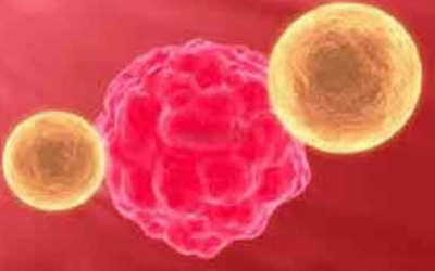 上海筹建最大干细胞医院，专家呼吁脐带血采集治疗进大病医保