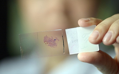 “它延缓了中国人吃上新药的时间” 遗传资源临床实验新政引争议