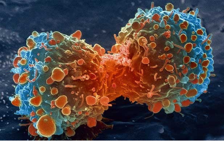 从另一个视角看CTC