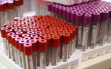 【干货】ICL市场分析(一)