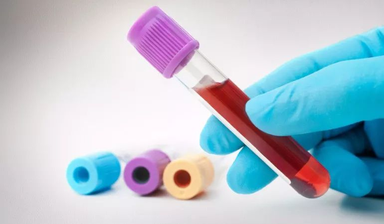 【PLOS Medicine】超好用的液体活检新方法，快速区分遗传病神经纤维瘤是否发生癌病