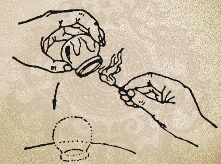 【Science子刊】拔罐＋新冠DNA疫苗＝免疫反应×100，华人科学家结合古代和现代医学，发明了一种新的转染方法！