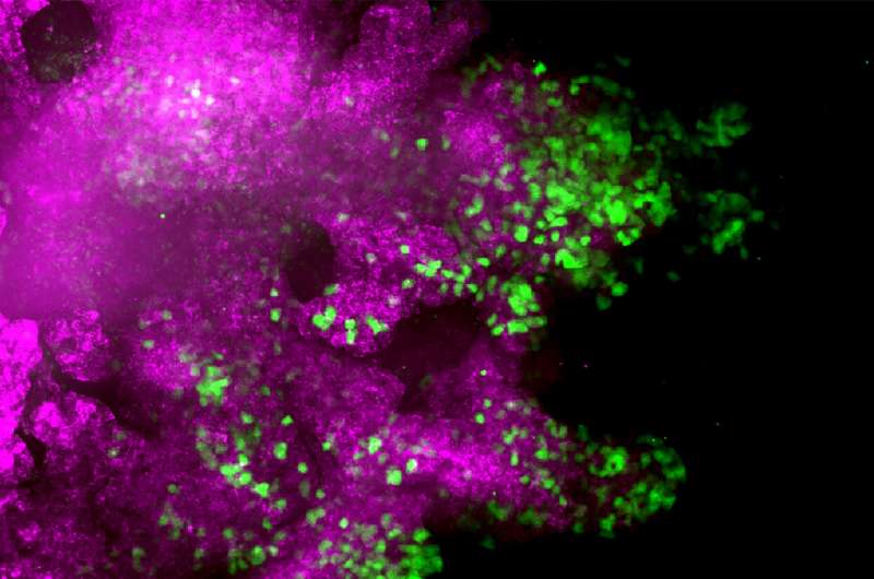 【Cell子刊】恶性肿瘤治疗新视野：抑制上皮细胞-间充质转化，一箭双雕！