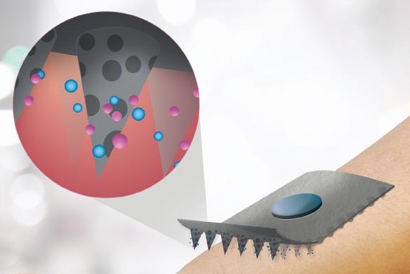 【ACS】还在害怕打针吃药？微针贴片有望消除此烦恼！