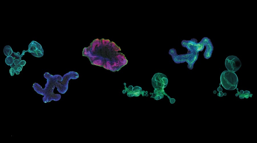 【Nature子刊】重磅！3D类器官修复受损肠道，临床应用前景广阔