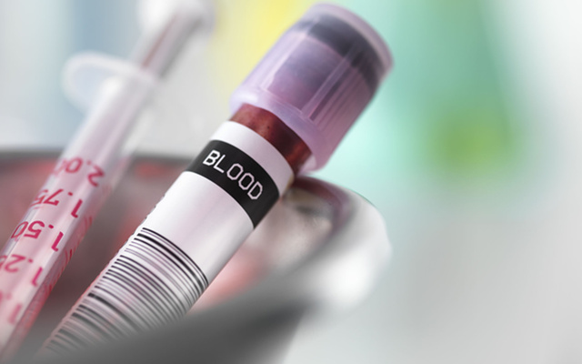 【研究】“验血”有望提前诊断阿尔茨海默病——在任何症状出现前