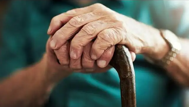 【Nature子刊】助力人类衰老研究！暨南大学的研究团队通过单细胞组学分析，揭示与老年衰弱综合征相关的特异性免疫单核细胞