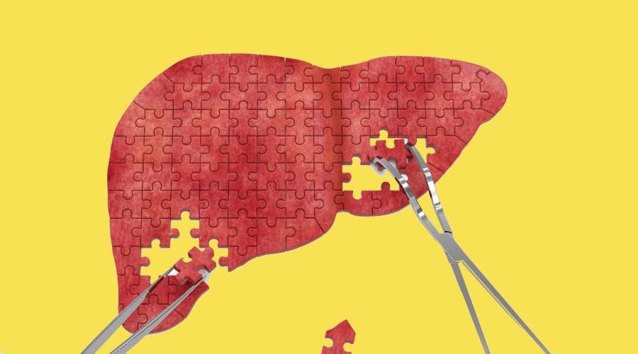 【Science子刊】一种受体的失活会减少肝纤维化，使抗纤维化治疗更近一步！