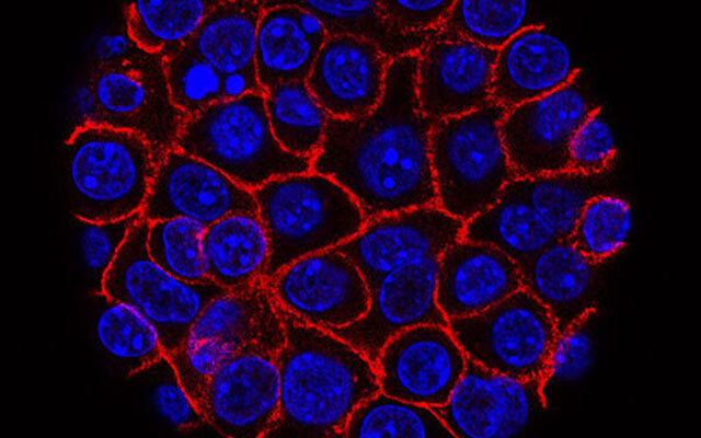 【Nature】操纵关键蛋白——逆转胰腺癌扩散！