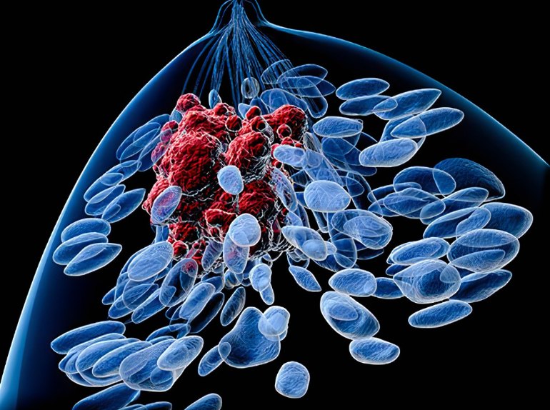 【Cell子刊】邵志敏团队再突破！瞄准细胞“铁死亡”，攻坚最凶险乳腺癌顽固堡垒!