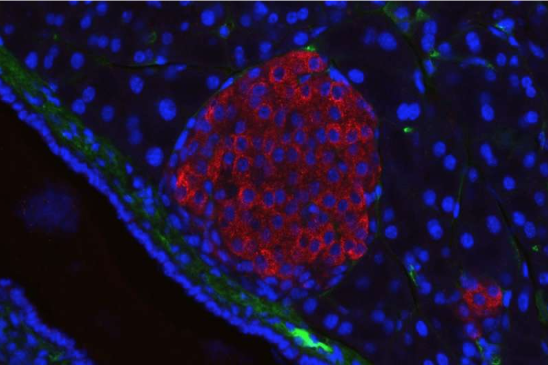 【JCEM】再续篇章！科学家绘制出糖尿病生化作用网络，开辟糖尿病治疗新世界！