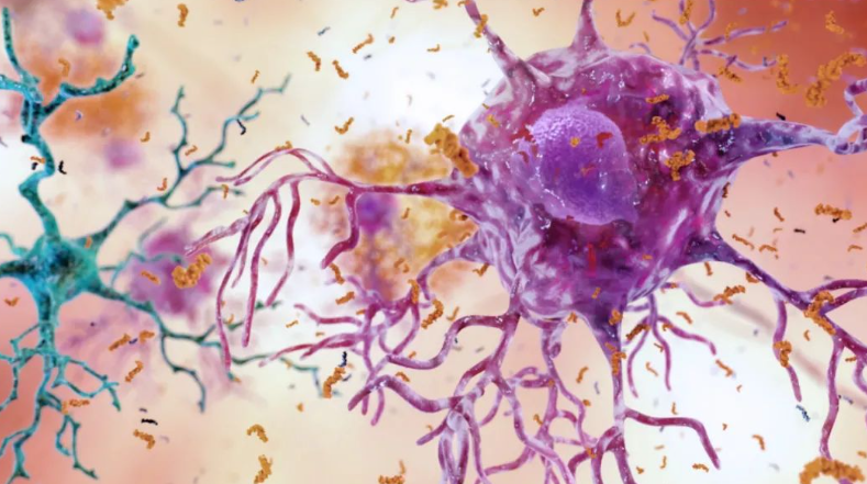 你有好好刷牙吗？新研究表明口腔疾病会引发阿尔兹海默症