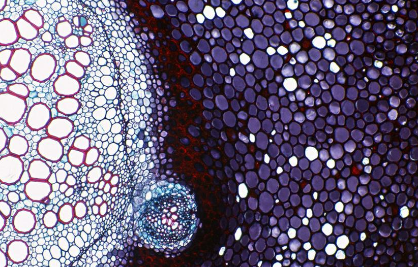 【JCO】再添新证！中山大学徐瑞华/王峰团队：这类食管癌患者也能从PD-1单抗联合化疗中显著获益