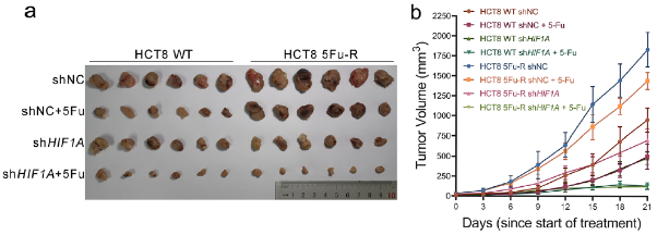 CTC检测在结直肠癌动态监测的临床应用