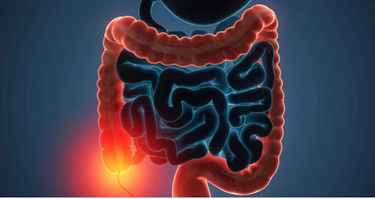 重磅！南开大学刘定斌/许晨发现可作为结直肠癌非侵入性诊断和预后的新型生物标志物
