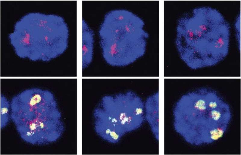 【Nature子刊】不换血！阻断这种炎症信号就能让衰老血液恢复年轻状态，成功逆转衰老