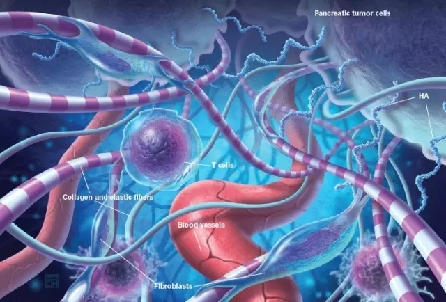 【Nature】重磅！肠道菌群中的这种代谢物或是增强胰腺癌疗效的关键！