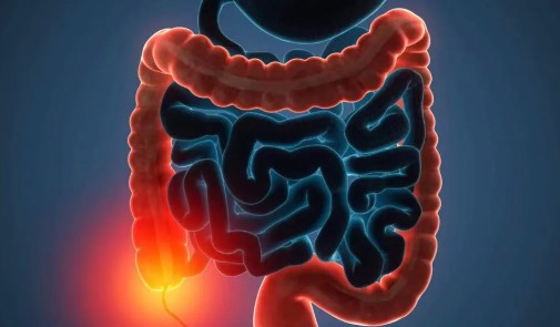 新进展！研究人员发现了结直肠癌细胞对化疗产生耐药性的机制