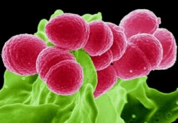 最新！中大邓铭权教授团队揭秘肿瘤相关细胞的关键因子，促进癌症治疗新靶点