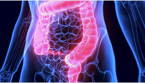 年龄越小影响越少！美国医学院揭示结直肠癌治疗新靶点