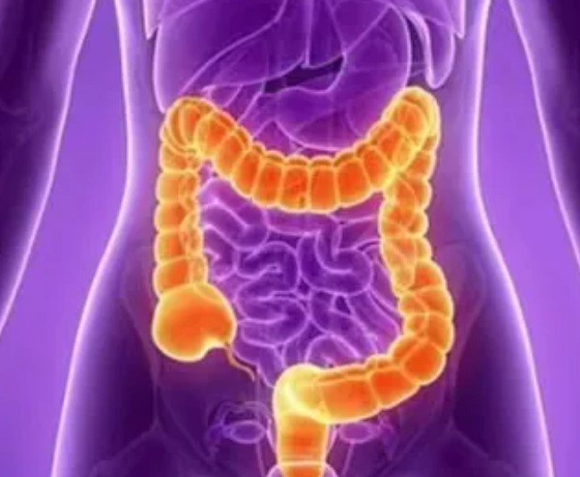 【STTT】再取进展！中山大学李孟鸿等研究发现结直肠癌治疗新靶点