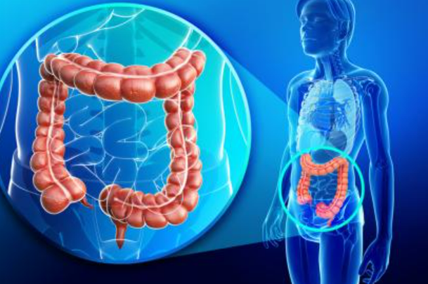 【Nature Medicine】科学家绘制结直肠癌肿瘤、免疫和微生物组综合图谱，助力个性化治疗