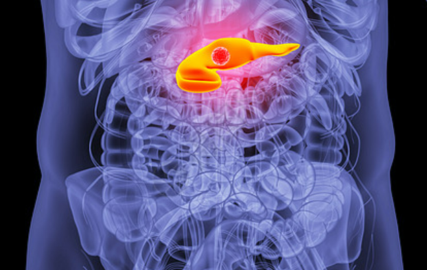 浙江大学赵鹏/陈东/顾臻/阮健开发新的凝胶，诱导肿瘤铁死亡依赖性免疫应答