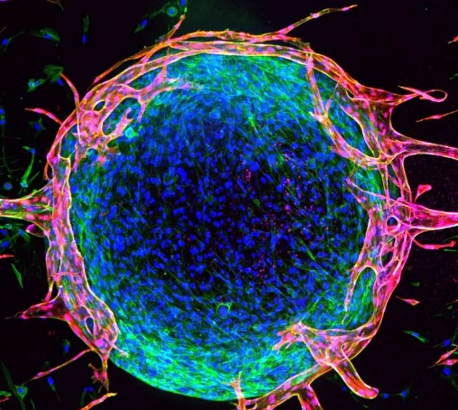 连发两篇！中南大学湘雅医院研究团队发表抗肿瘤免疫治疗原创成果