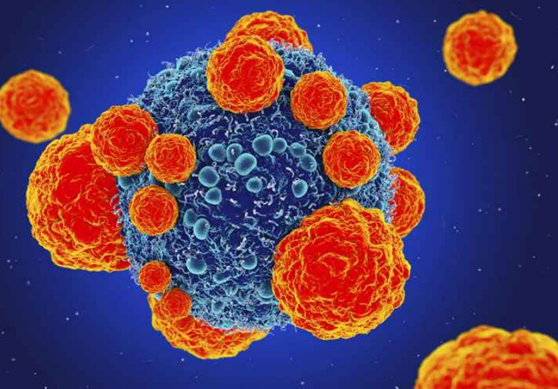 最新！北京协和携手四川华西等发表迄今国内规模最大的癌症研究成果