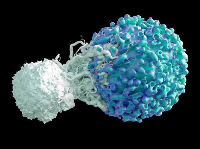 最新！中南湘雅团队发表重大综述 并提出靶向糖酵解免疫治疗的新策略