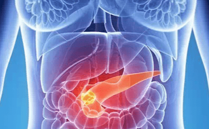 抑制癌细胞的增殖和生长！上海交大发现胰腺癌治疗新方法！