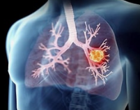 前所未有！西安交大揭示肺癌抗药性的潜在机制，创新探索为肺癌晚期带来希望！