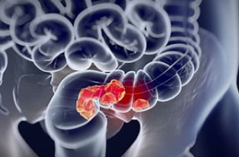 【Advanced Science】男性更危险？最新研究揭示结直肠癌性别差异背后的机制和潜在治疗靶点！