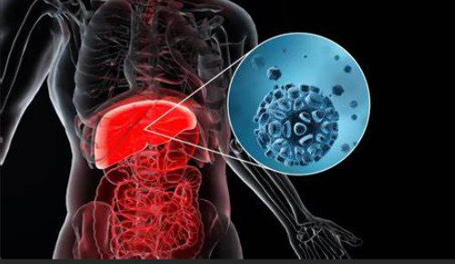 香港中文大学发现肝细胞癌的新型预防措施！