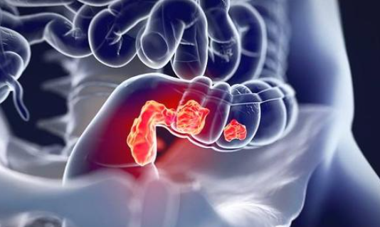 最新！中国医学科学院研究发现丙泊酚可抑制结肠癌细胞的干性，或具有抗癌能力！