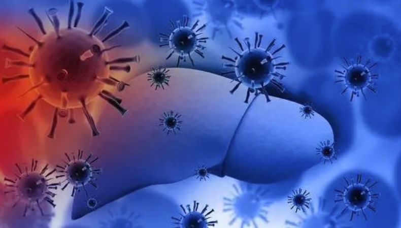 “低”成本“高”疗效！中国学者发现晚期肝细胞癌伴肝外转移的治疗新策略