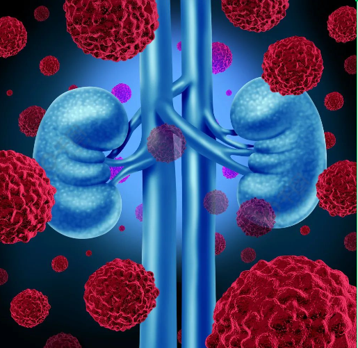 新靶点！上海交大发文：揭示肾细胞癌治疗新策略