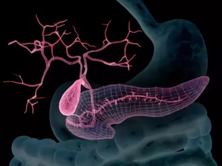 发挥致癌作用！浙江大学梁廷波团队：发现“癌中之王”胰腺癌最新靶点