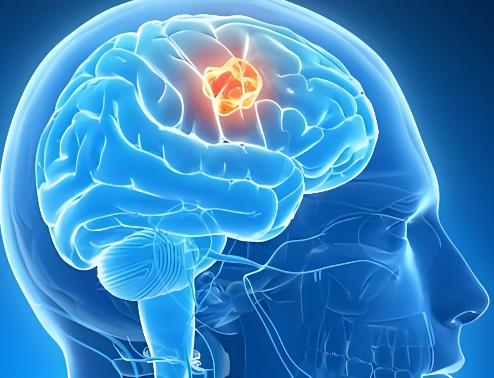 代谢重塑！厦门大学/上海交大季天海团队发现胶质瘤治疗新药