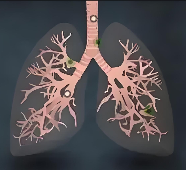 联合治疗！天津医科大学发文：揭示非小细胞肺癌治疗新策略