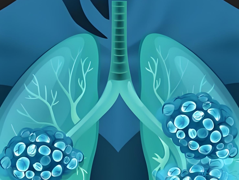 【Nature子刊】深圳大学吴昊团队发文：揭示肺癌免疫治疗新思路