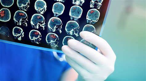 【Lancet】突破性！中科院田捷团队研发出针对神经胶质瘤手术的精确探针！