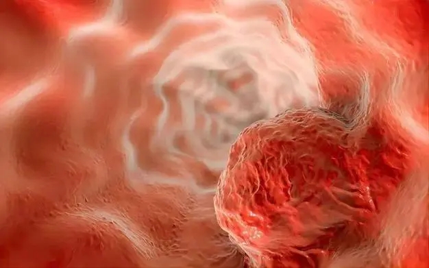 【CTM】西安交通大学赵茜茜/马红兵团队发文：食管鳞癌的潜在治疗靶点