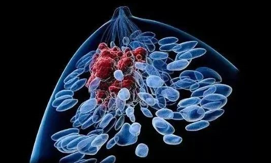可使癌细胞死亡和肿瘤消退！南京医科大学发文：“最毒乳腺癌”的靶向治疗新策略